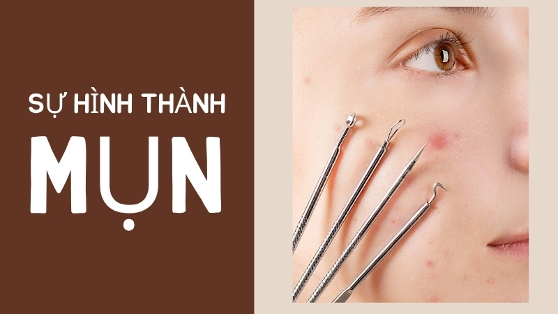 Bã nhờn giúp sản xuất dầu tự nhiên giúp giữ ẩm cho da