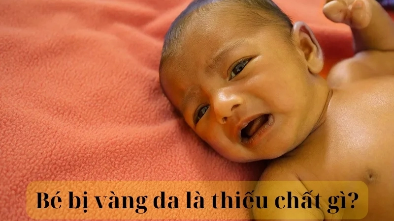 Bé bị vàng da là thiếu chất gì?