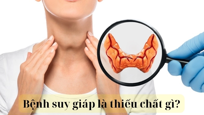 Bệnh suy giáp là thiếu chất gì? 