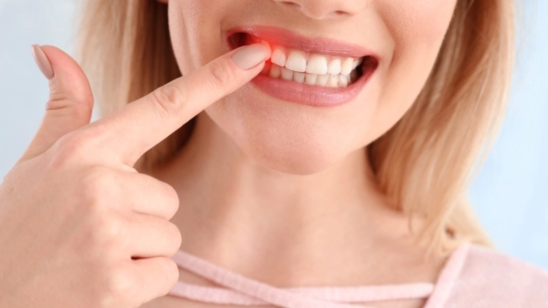 Lưu ý quan trọng khi bị chảy máu chân răng