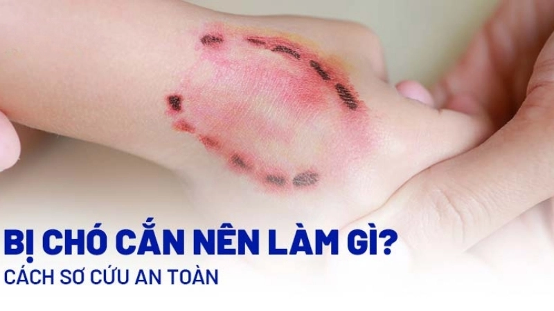 Mẹo và biện pháp chữa trị khi bị chó cắn