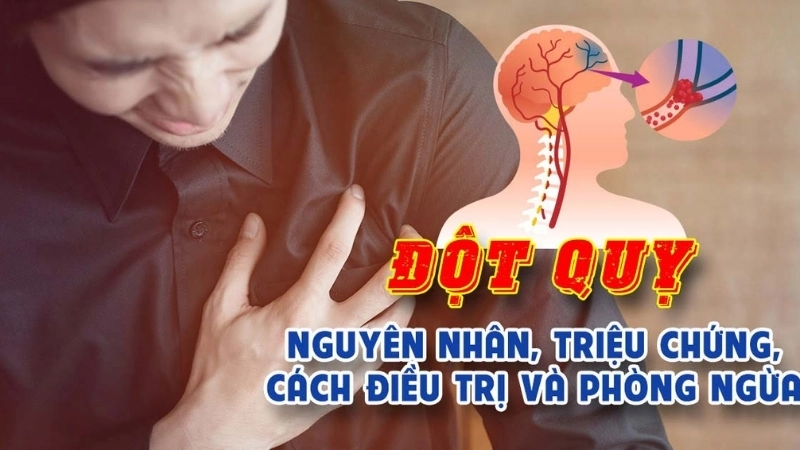 Bị đột quỵ có sao không?