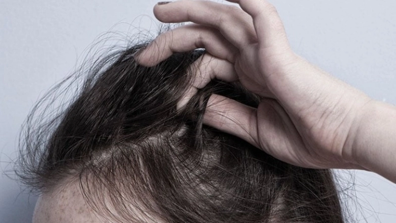 Mẹo và biện pháp chữa trị khi bị giật tóc