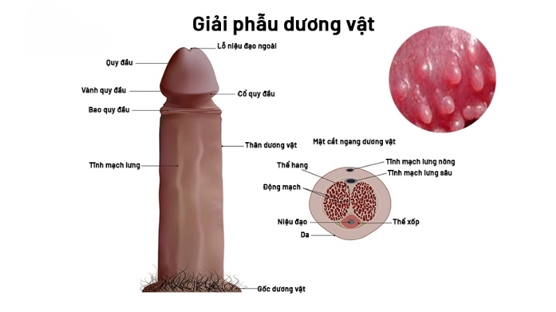 Bị hạt ngọc có sao không?