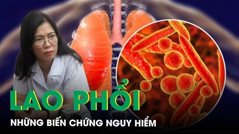 Dấu hiệu nhận biết khi bị lao phổi