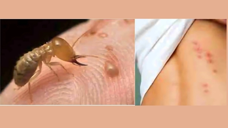 Triệu chứng khi bị mối cắn