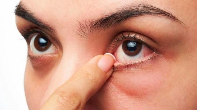 Bị ngứa mắt có sao không?