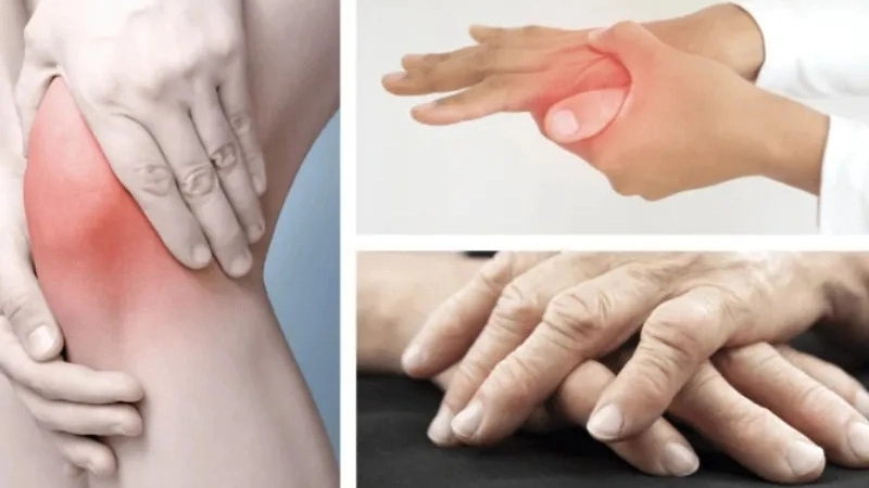 Triệu chứng khi bị phong thấp