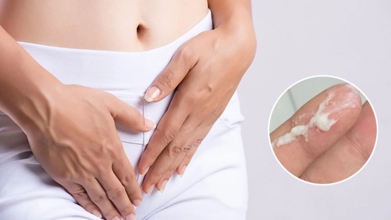 Phương pháp và mẹo chữa trị khi bị ra huyết trắng nhiều