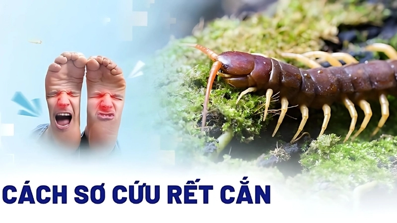 Cách xử lý khi bị rết cắn