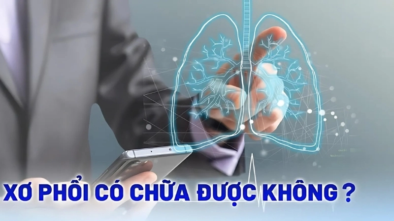 Dấu hiệu nhận biết khi bị xơ phổi