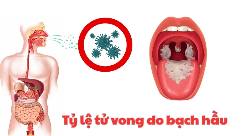  Biểu đồ tỷ lệ tử vong do bạch hầu ở các nhóm tuổi khác nhau