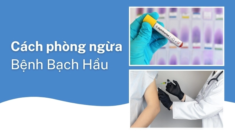 Cách phòng bệnh bạch hầu hiệu quả nhất là thông qua tiêm chủng