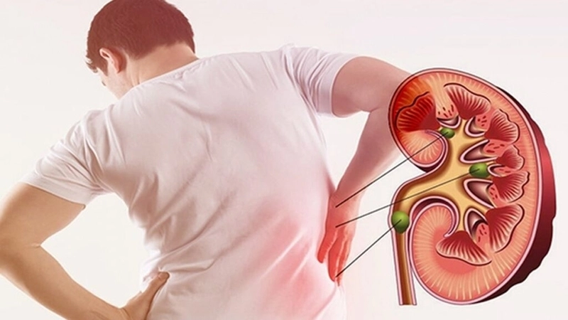 Tác dụng phụ của CaCO₃ cần lưu ý