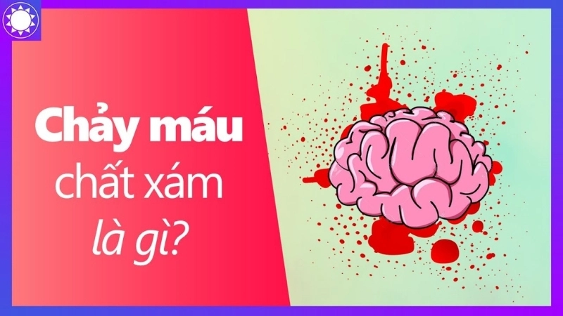 Chảy máu chất xám là gì?
