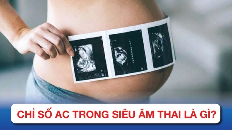 Chỉ số AC trong siêu âm thai là gì?
