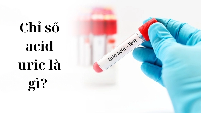 Chỉ số acid uric là gì? 