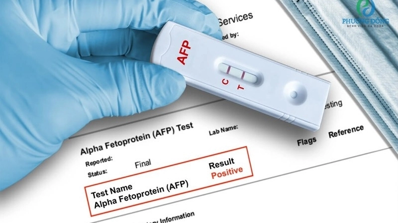 Ứng dụng chỉ số AFP trong y học hiện đại
