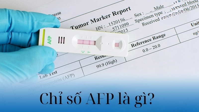 Chỉ số AFP là gì?