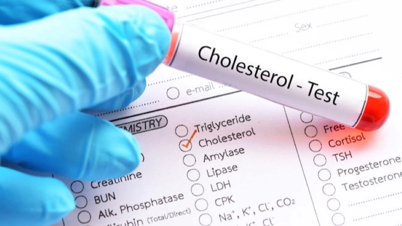 Các thành phần của chỉ số cholesterol