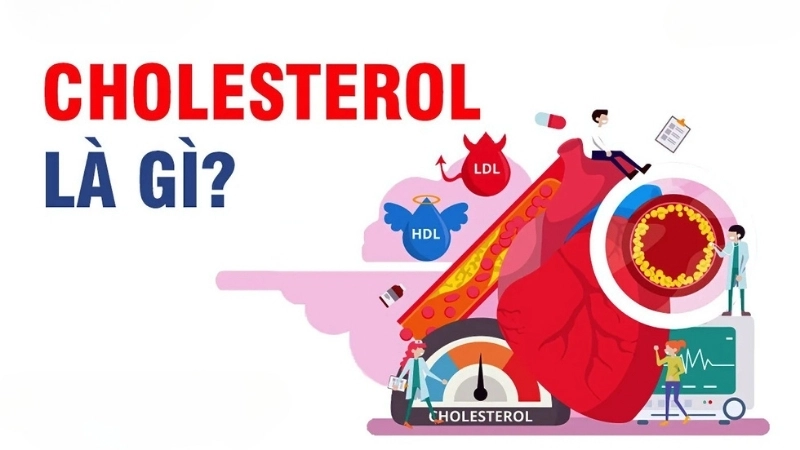 Chỉ số cholesterol là gì?