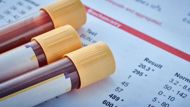 Dấu hiệu nhận biết chỉ số creatinin bất thường