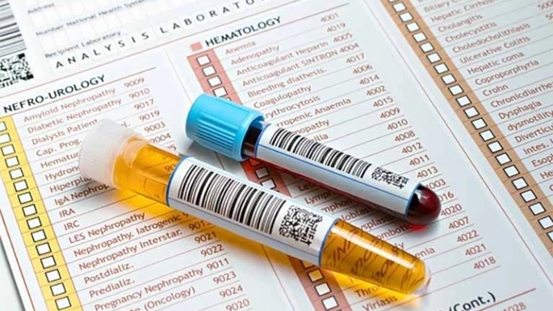 Làm gì để ổn định chỉ số creatinin?