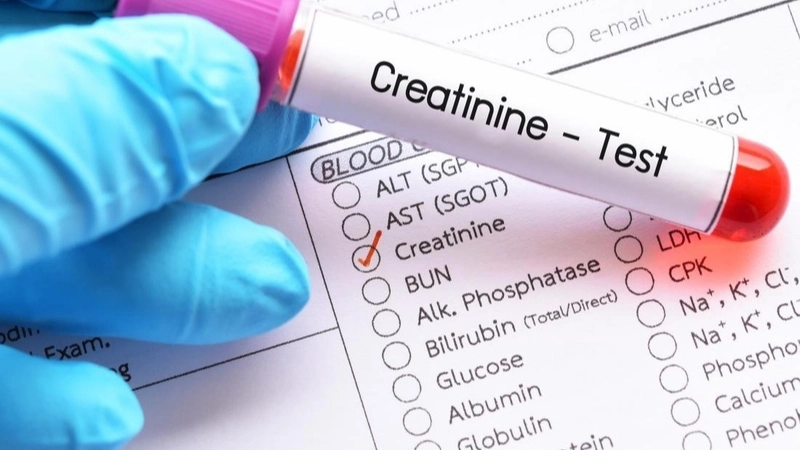 Ý nghĩa lâm sàng của các chỉ số xét nghiệm creatinine