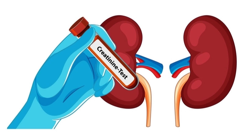 Tăng chỉ số creatinine có thể báo hiệu điều gì?