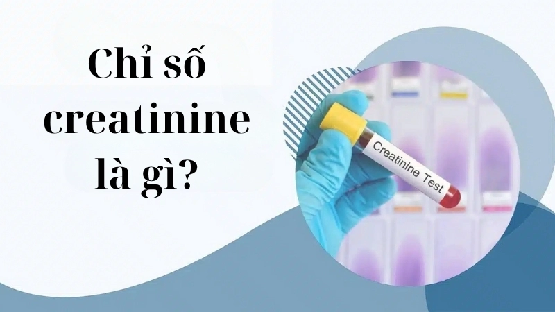 Chỉ số creatinine là gì?
