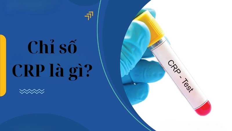 Chỉ số CRP là gì? 