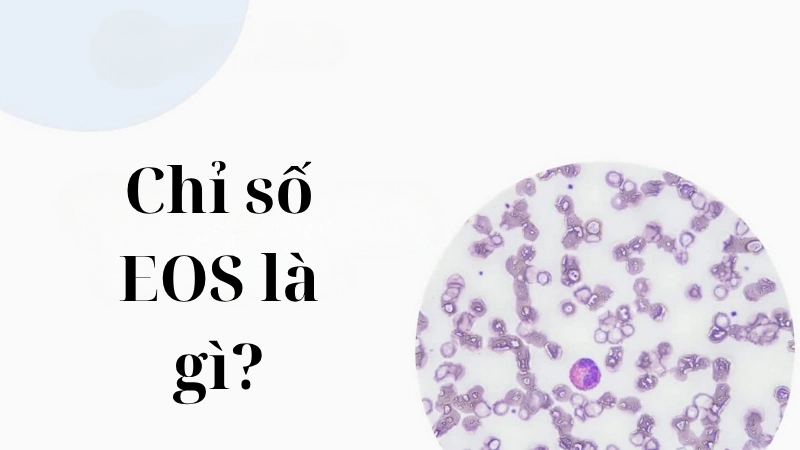 Chỉ số EOS là gì?
