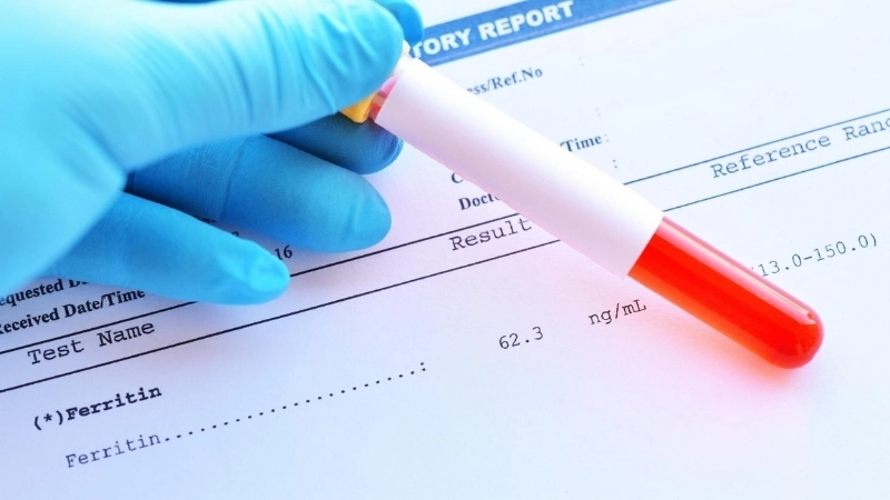Cần chuẩn bị gì khi xét nghiệm ferritin?