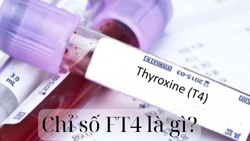 Chỉ số FT4 là gì?