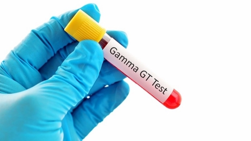 Lưu ý quan trọng khi xét nghiệm Gamma GT