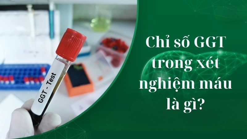 Chỉ số GGT trong xét nghiệm máu là gì?