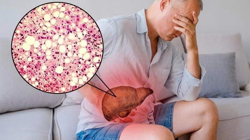 Biện pháp phòng ngừa tăng men gan GPT hiệu quả