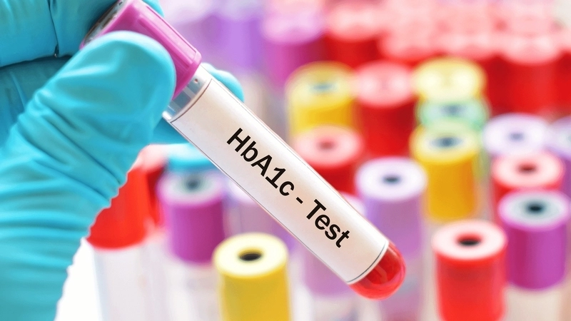 Nguyên nhân khiến HbA1c tăng cao