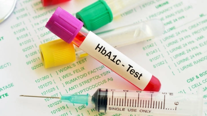 Cách kiểm soát chỉ số HbA1c hiệu quả