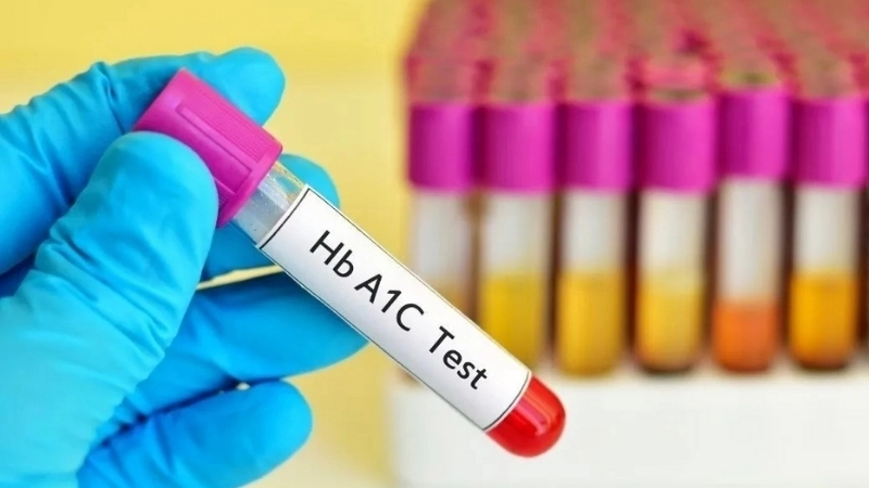 Bao lâu nên kiểm tra chỉ số HbA1c?