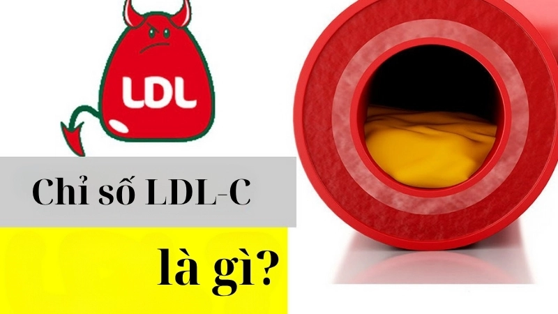 Chỉ số LDL-C là gì?