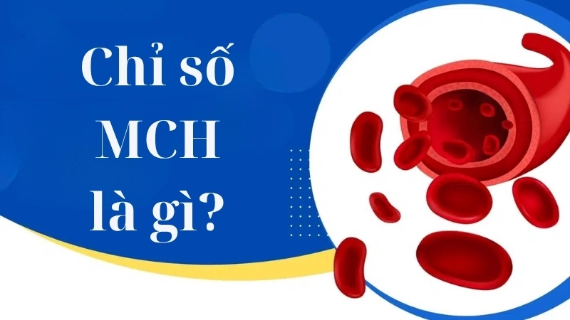 Chỉ số MCH là gì?