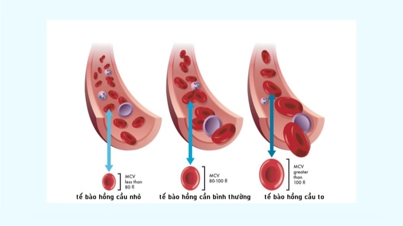 Chỉ số MCV phản ánh điều gì?