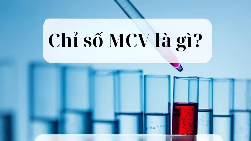 Chỉ số MCV là gì?