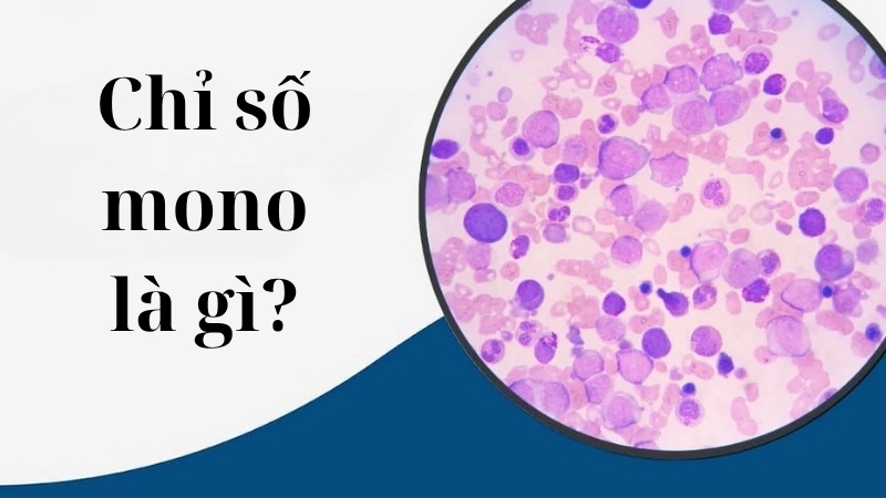 Chỉ số mono là gì?