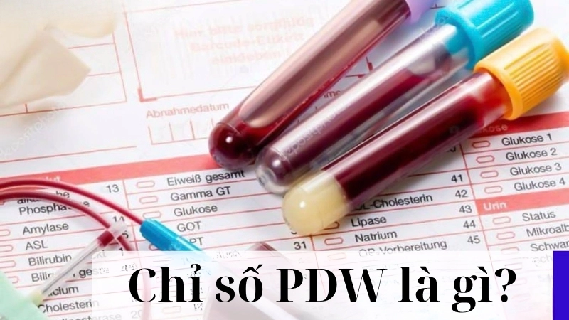 Chỉ số PDW là gì trong xét nghiệm máu?