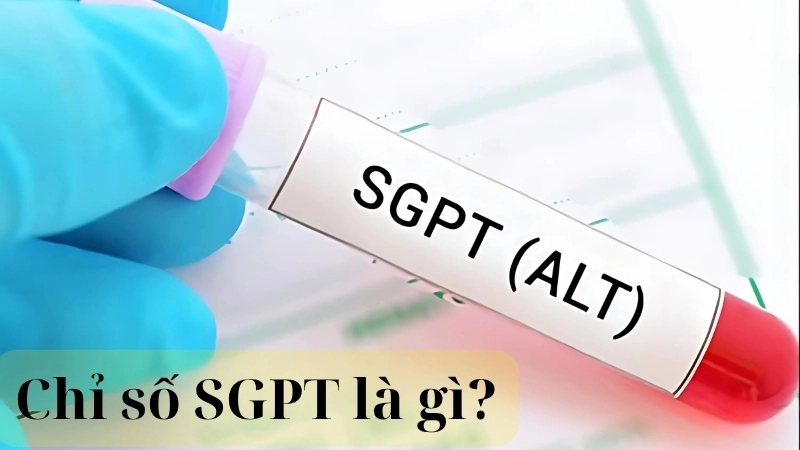 Chỉ số SGPT là gì?