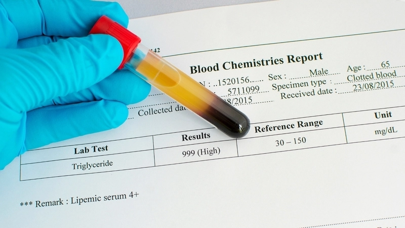 Làm thế nào để kiểm soát chỉ số Triglyceride?