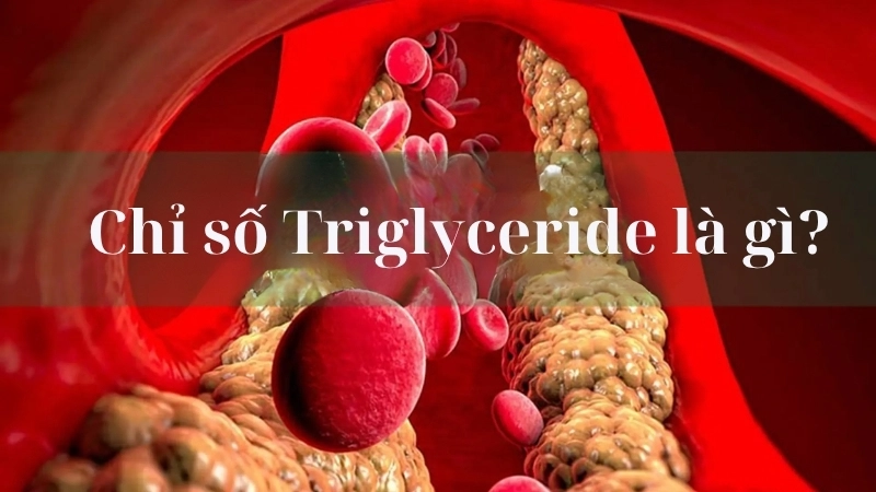 Chỉ số Triglyceride là gì?