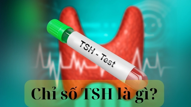 Chỉ số TSH là gì?